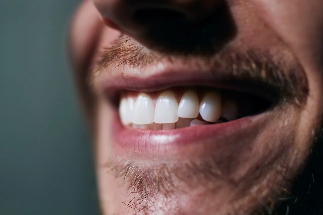 Digital Smile Design